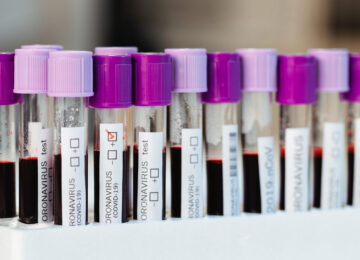 Closed flasks with positive and negative blood tests for Covid-19 in the laboratory